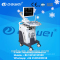 doppler ultrasound price color doppler laptop ultrasound